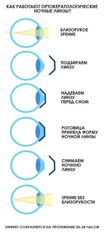 Маркировка фар автомобиля под ксенон и галоген (hrc): обозначение в машине светодиодных ламп | dorpex.ru